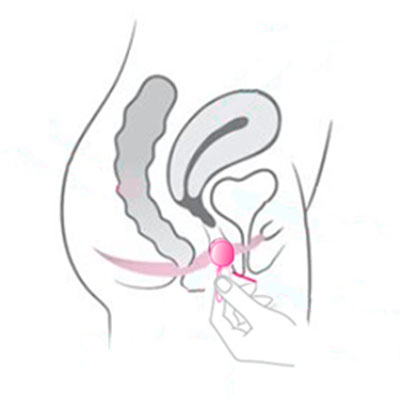 como se colocan bolas chinas